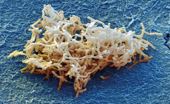 Jak zapanować nad szkodnikami i chorobami? Metody biologiczne a chemiczne